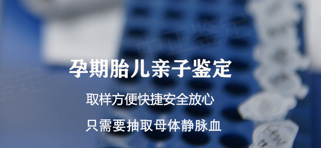 呼和浩特孕期亲子鉴定机构报告需要多久出来, 呼和浩特孕期亲子鉴定机构报告需要多久出来,