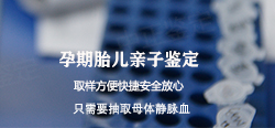 呼和浩特孕期亲子鉴定机构报告需要多久出来 呼和浩特孕期亲子鉴定机构报告需要多久出来